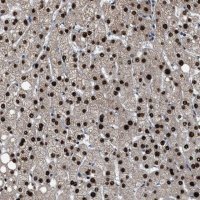 Anti-ZNF20 antibody produced in rabbit 
