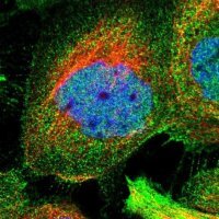 Anti-ZNF20 antibody produced in rabbit 