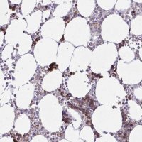 Anti-ZNF221 antibody produced in rabbit 