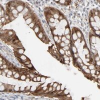 Anti-ZNF222 antibody produced in rabbit HPA004086-100UL