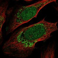 Anti-ZNF223 antibody produced in rabbit 