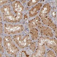 Anti-ZNF234 antibody produced in rabbit 