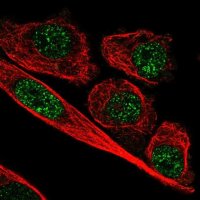 Anti-ZNF248 antibody produced in rabbit 
