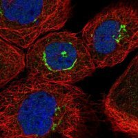 Anti-ZNF25 antibody produced in rabbit 