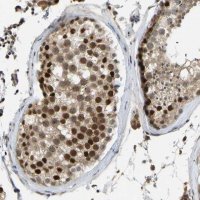 Anti-ZNF251 antibody produced in rabbit 
