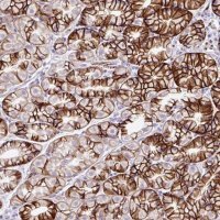 Anti-ZNF256 antibody produced in rabbit 