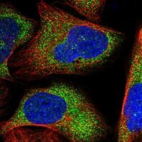 Anti-ZNF263 antibody produced in rabbit 