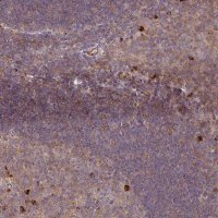 Anti-ZNF266 antibody produced in rabbit 