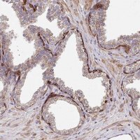 Anti-ZNF268 antibody produced in rabbit