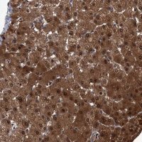Anti-ZNF274 antibody produced in rabbit 