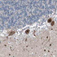 Anti-ZNF276 antibody produced in rabbit 