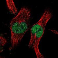 Anti-ZNF277 antibody produced in rabbit