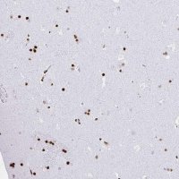 Anti-ZNF280C antibody produced in rabbit 