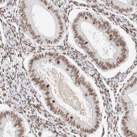 Anti-ZNF282 antibody produced in rabbit