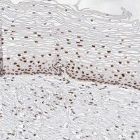 Anti-ZNF282 antibody produced in rabbit