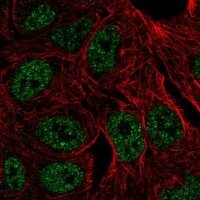 Anti-ZNF283 antibody produced in rabbit 