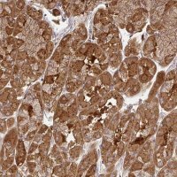 Anti-ZNF285 antibody produced in rabbit 