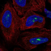 Anti-ZNF286A antibody produced in rabbit 