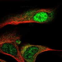 Anti-ZNF286B antibody produced in rabbit 