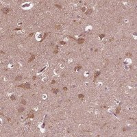 Anti-ZNF292 antibody produced in rabbit 