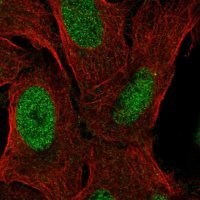 Anti-ZNF296 antibody produced in rabbit 