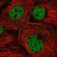 Anti-ZNF317 antibody produced in rabbit 