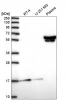 Anti-ZNF317 antibody produced in rabbit