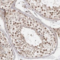 Anti-ZNF318 antibody produced in rabbit 