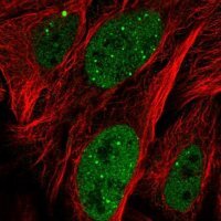 Anti-ZNF32 antibody produced in rabbit 