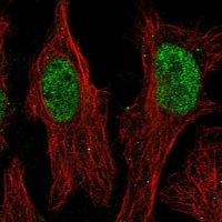 Anti-ZNF320 antibody produced in rabbit 
