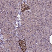 Anti-ZNF329 antibody produced in rabbit 