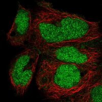 Anti-ZNF331 antibody produced in rabbit 