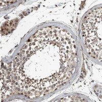 Anti-ZNF345 antibody produced in rabbit 