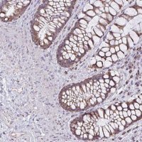 Anti-ZNF362 antibody produced in rabbit 