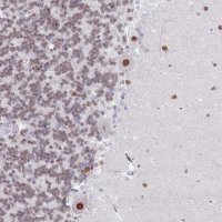 Anti-ZNF382 antibody produced in rabbit 