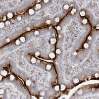 Anti-ZNF385D antibody produced in rabbit 
