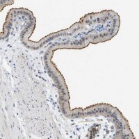 Anti-ZNF408 antibody produced in rabbit 