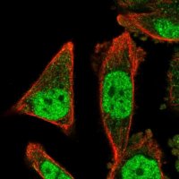 Anti-ZNF414 antibody produced in rabbit