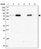 Anti-ZNF417 antibody produced in rabbit HPA042125-100UL