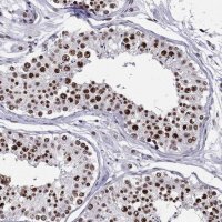 Anti-ZNF420 antibody produced in rabbit 