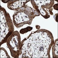 Anti-ZNF451 antibody produced in rabbit HPA028838-100UL