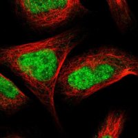 Anti-ZNF462 antibody produced in rabbit 