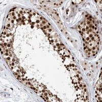 Anti-ZNF470 antibody produced in rabbit
