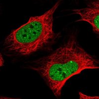 Anti-ZNF470 antibody produced in rabbit