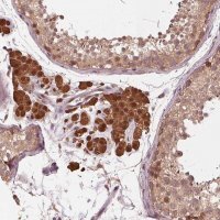 Anti-ZNF471 antibody produced in rabbit HPA066695-100UL