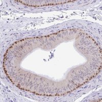 Anti-ZNF485 antibody produced in rabbit 