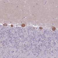 Anti-ZNF501 antibody produced in rabbit 