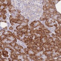 Anti-ZNF510 antibody produced in rabbit 