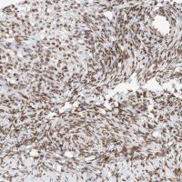 Anti-ZNF512 antibody produced in rabbit 