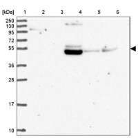Anti-ZNF513 antibody produced in rabbit 